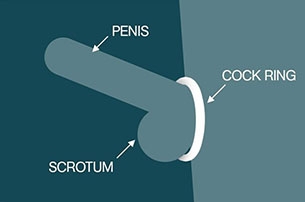 Penis Halkası
